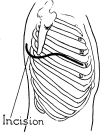 Fig. 11.