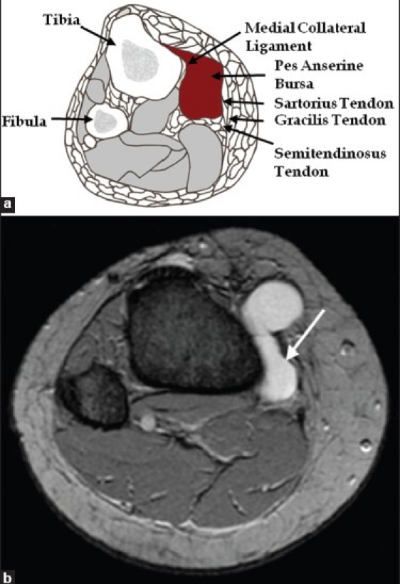 Figure 17