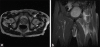 Figure 22