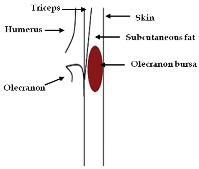 Figure 27