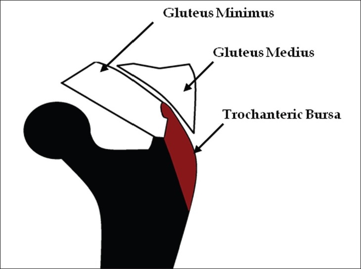 Figure 23