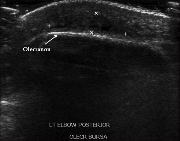 Figure 29