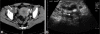 Figure 30