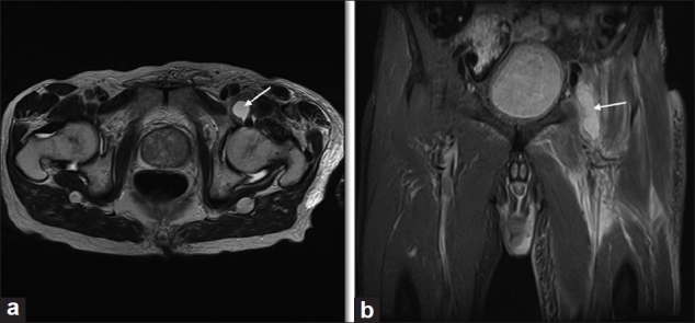 Figure 22