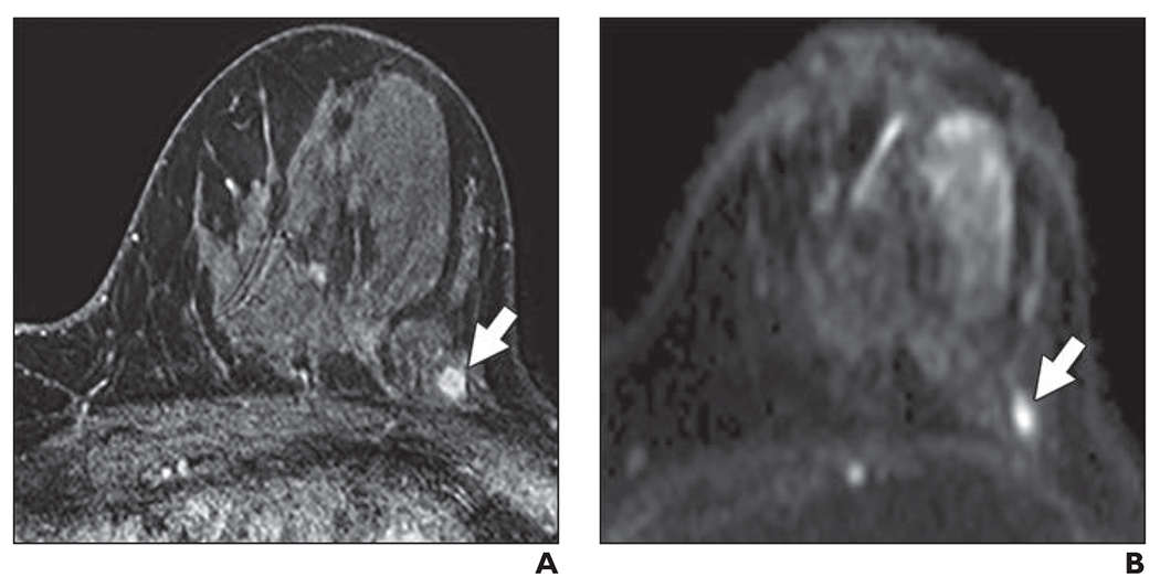 Fig. 2—