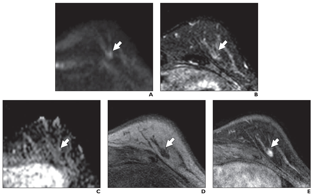 Fig. 9—