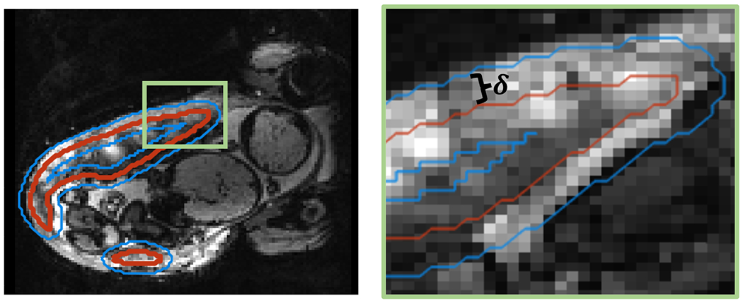 Figure 2: