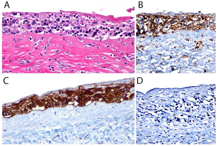 Figure 17