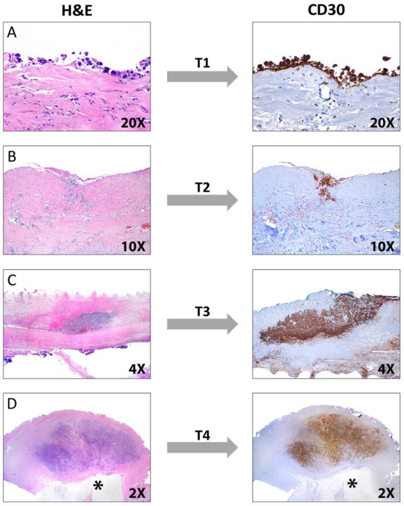 Figure 18