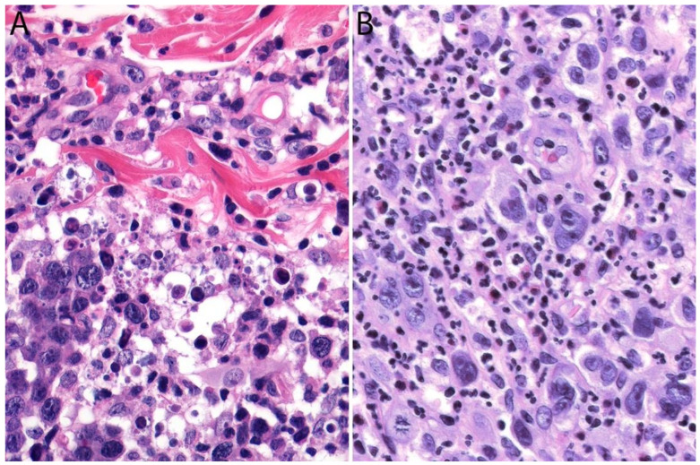 Figure 14