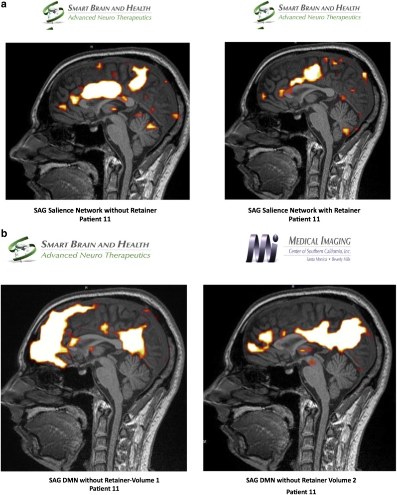 Fig. 6