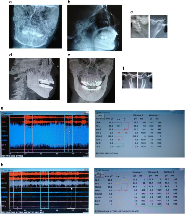 Fig. 3