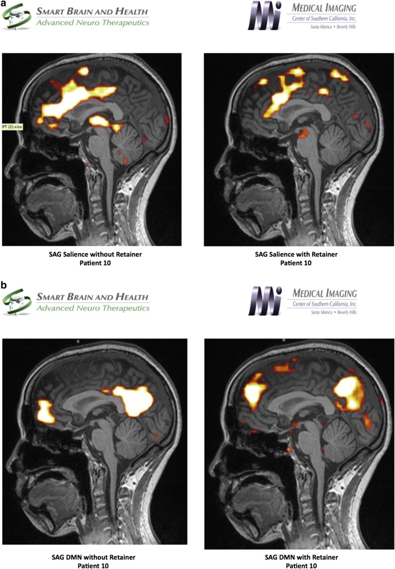 Fig. 4