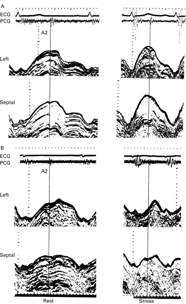 Figure 2  