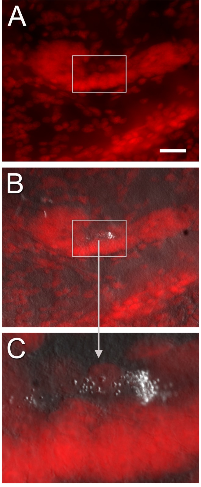 Figure 11