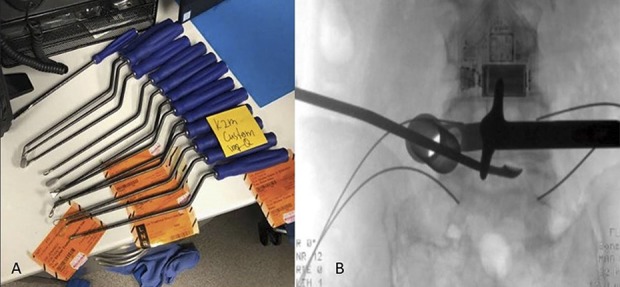 Fig. 3 A-B