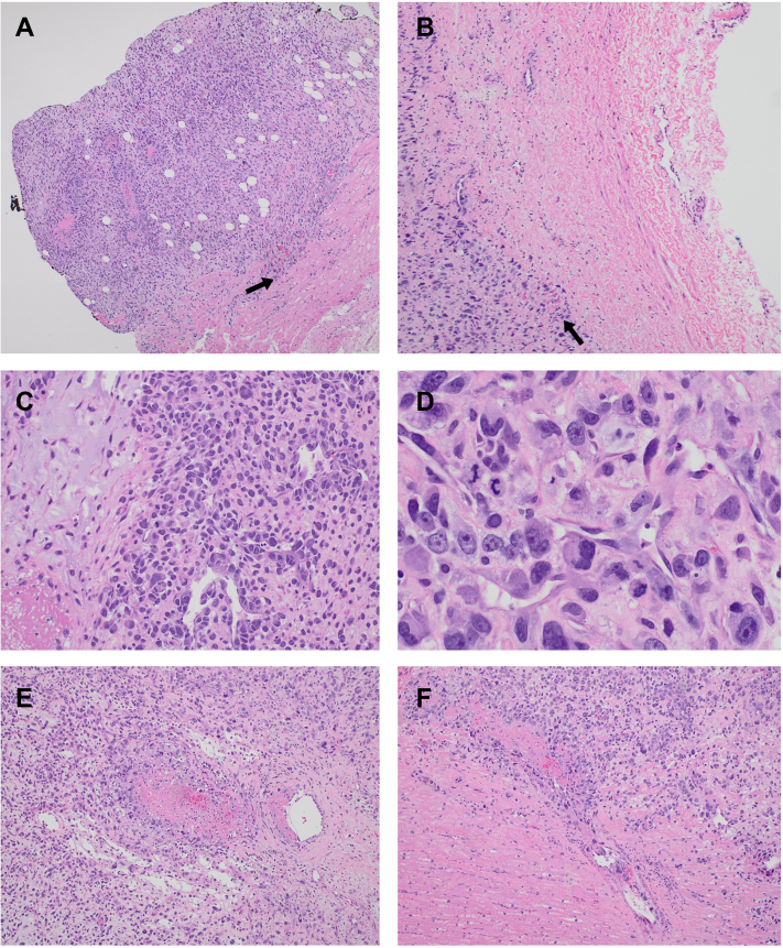 Figure 6