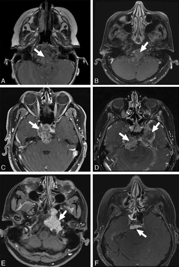 Fig 3.