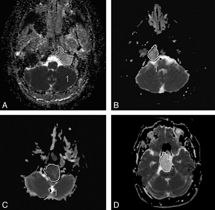 Fig 2.