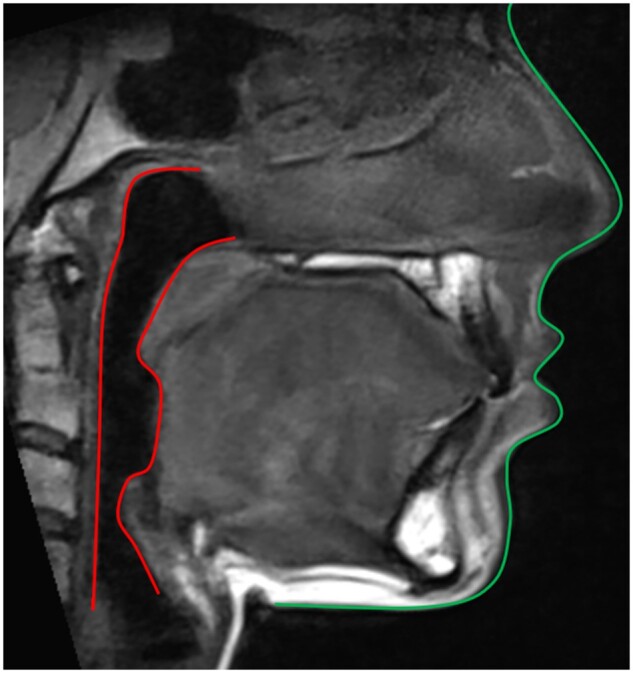 Figure 6.