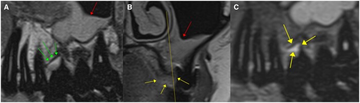 Figure 11.