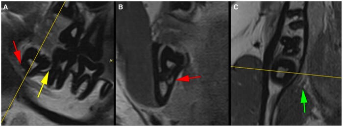 Figure 12.