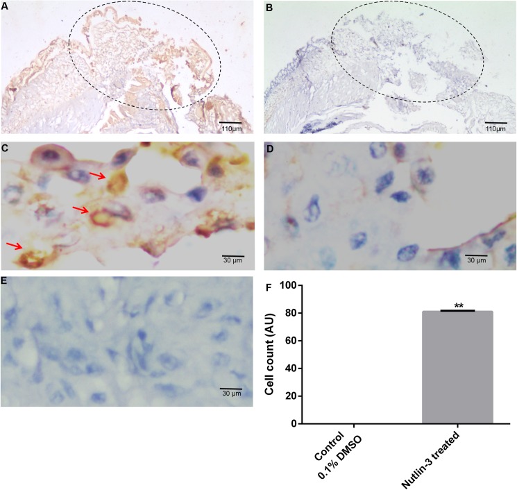 Fig 13