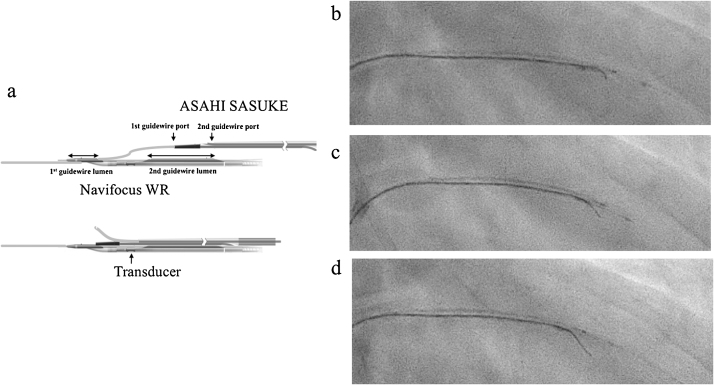 Fig. 3