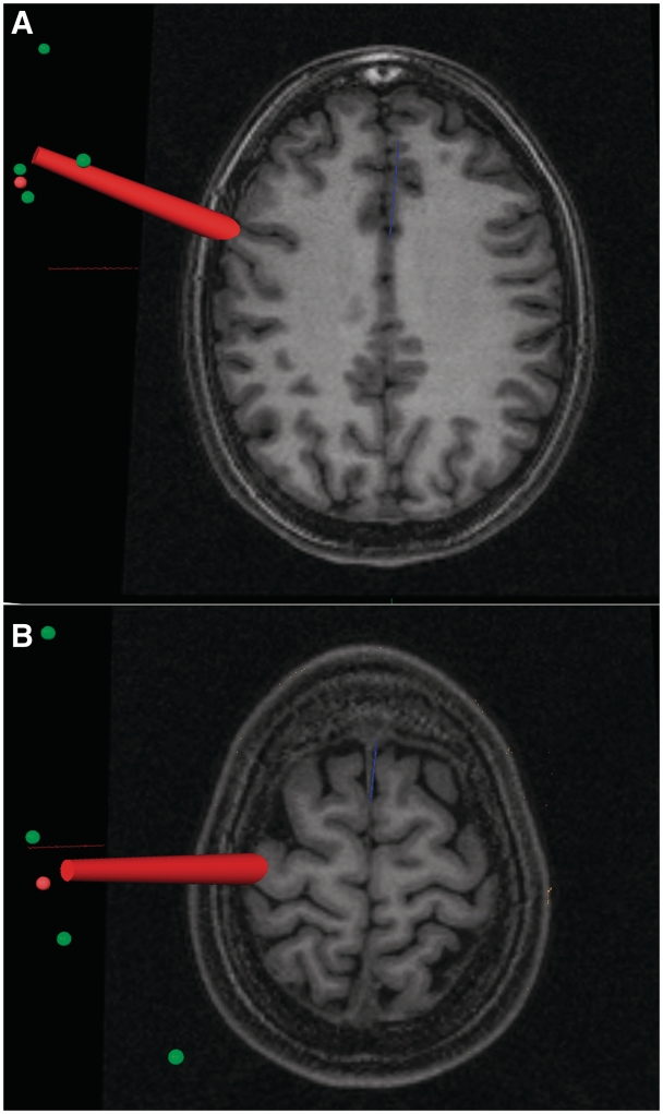 Fig. 3