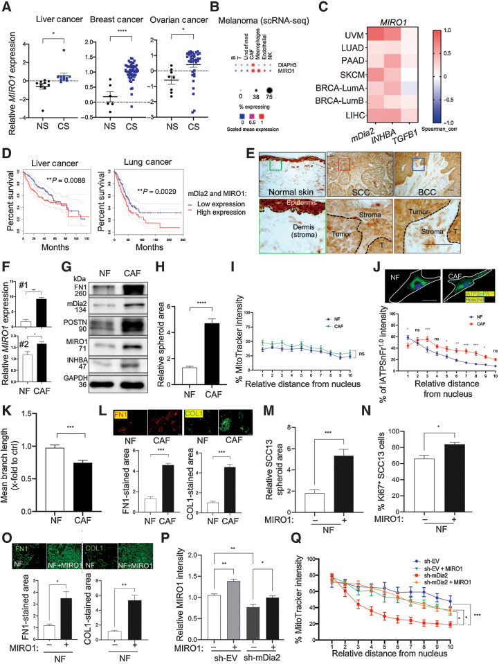 Figure 4. Overexpression of mDia2 and MIRO1 in CAFs promotes tumorigenesis. A, Expression of MIRO1 in liver, breast, and ovarian cancer stroma (CS) vs. stroma of respective normal tissues (NS) based on data sets GSE45001 (N = 10 per group), GSE9014 (N = 6 and 53), and GSE40595 (N = 8 and 36). B, Single-cell expression profiles of mDia2/DIAPH3 and MIRO1 in immune cells, endothelial cells, and CAFs of melanomas based on data from Single-Cell Portal (Broad Institute). C, Correlation analysis between MIRO1 and mDia2, INHBA, and TGFB1 gene expression across different cancers using TIMER2. UVM: uveal melanoma; LUAD: lung adenocarcinoma; PAAD: pancreatic ductal adenocarcinoma; SKCM: skin cancer cutaneous melanoma, BRCA-Lum: luminal breast cancer; LIHC: liver hepatocellular carcinoma. The red or blue color indicates a statistically significant positive/negative correlation (Spearman, P < 0.05), respectively, and gray denotes a nonsignificant result. D, Kaplan–Meier survival curves based on TCGA and GTEx data. High expression of mDia2/DIAPH3 and MIRO1 in patients with liver or lung cancer correlates with poor survival. E, Representative sections from normal human skin, cSCC, and BCC stained for MIRO1. Scale bars: 100 μm. T: tumor cells. F, qRT-PCR analysis for MIRO1 using RNA from CAFs or NFs from two SCC patients. n = 3. G, Representative Western blot of total lysates of NFs and CAFs from patient No. 1 for MIRO1, CAF markers, and GAPDH. H, Quantification of SCC13 tumor spheroid area in hanging drop including CM from NF and CAFs. n = 10–11. I, Mitochondrial distribution in NFs or CAFs from patient No.1. n = 15–19. J, Representative images and bar graph showing fluorescence intensity distribution of ATP biosensor (cyto-Ruby3-iATPSnFR1.0) relative to the highest intensity value from the perinuclear region to the plasma membrane of NFs and CAFs (patient No. 1). n = 19. K, Mitochondrial branch length of NFs or CAFs (patient No.1). n = 15–19. L, Representative immunofluorescence images of decellularized matrices obtained from NFs and CAFs (patient No. 1) stained for FN1 and COL1A1 and quantification of the stained area. n = 3. M, Quantification of SCC13 tumor spheroid area in hanging drop including CM from NFs transfected with an expression vector encoding human MIRO1 (pGEM‐MIRO1 “+”) or empty vector (pGEM‐EV “–”). The spheroid area in one control sample was set to 1. n = 10–12. N, SCC13 cells plated on either decellularized matrix from NFs transfected with pGEM‐MIRO1 or pGEM‐EV. After 3 days, the number of Ki67-positive SCC13 cells was quantified. n = 3. O, Representative FN1 and COL1A1 immunofluorescence stainings and quantification of the stained area in the decellularized matrix derived from NFs transfected with pGEM‐MIRO1 or pGEM‐EV. n = 3. P and Q, sh-EV and sh-mDia2 fibroblasts were transfected with pGEM‐MIRO1 (“+”) or pGEM‐EV (“–”). Expression of MIRO1 was analyzed by immunofluorescence 24 hours after transfection (P). n = 3. Bar graph shows the fluorescence intensity distribution of MitoTracker relative to the highest intensity value from the perinuclear region to the plasma membrane (Q). n = 6–8. Bar graphs show mean ± SEM. ns P > 0.05; *, P < 0.05; **, P < 0.01; ***, P < 0.001; ****, P < 0.0001 [one-way ANOVA with Bonferroni post hoc test (P), two-way ANOVA with Bonferroni post hoc test (I, J, Q), unpaired Student t test (A, F, H, K–O)]. Scale bars: 50 μm.