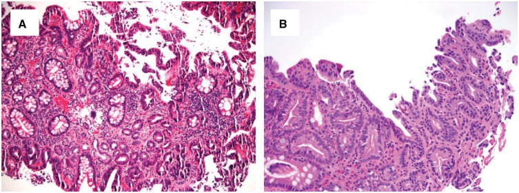 Figure 11.