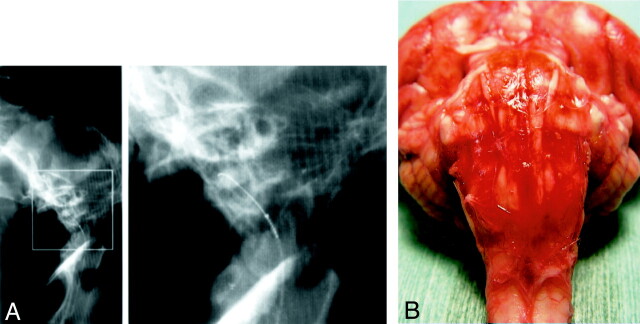 Fig 1.