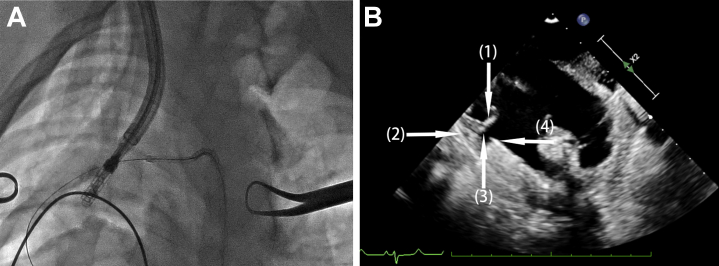 Figure 2