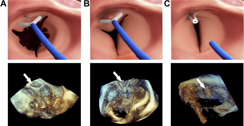 Figure 3