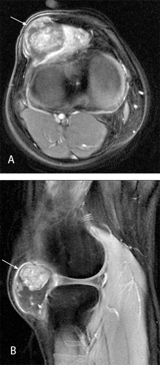 Fig. 3A & B