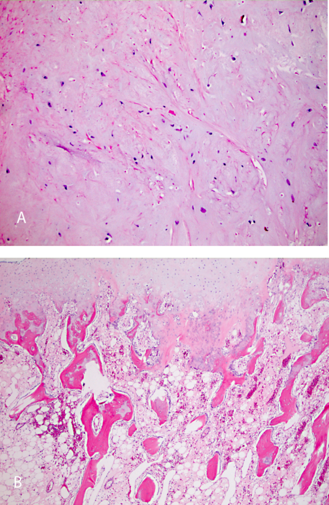 Fig. 4A & B