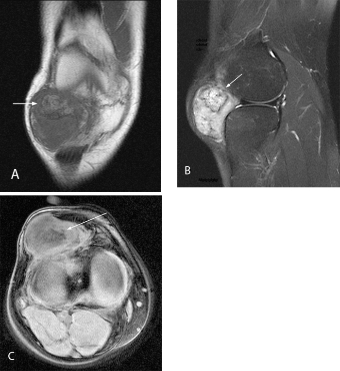 Fig. 2A, B, C