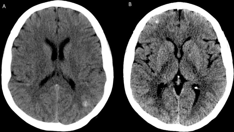 Fig 1