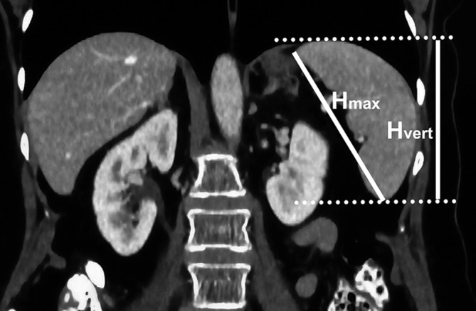 Fig. 2