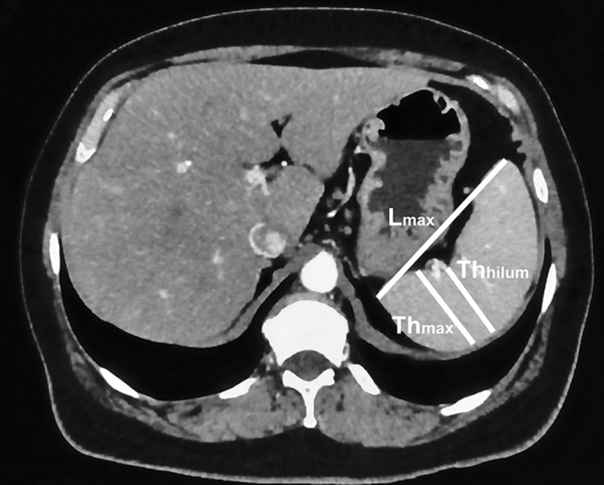 Fig. 1