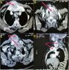 Fig. 1