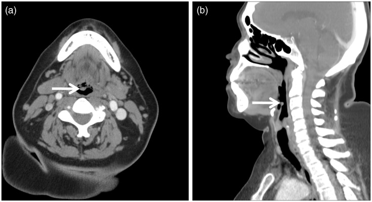 Figure 2.