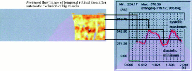 Figure 3  