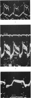 481