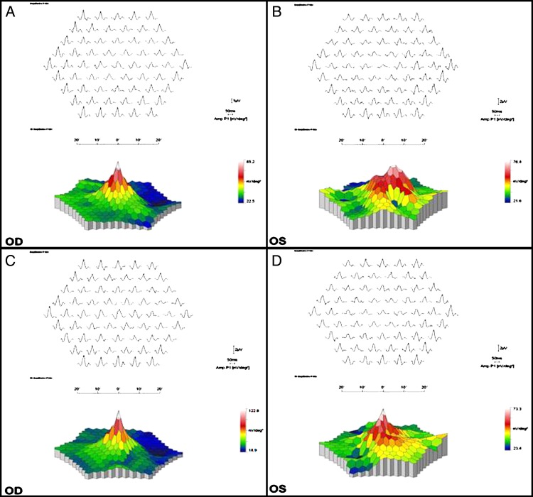 Figure 2