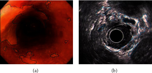 Figure 12