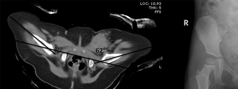 Fig. 1