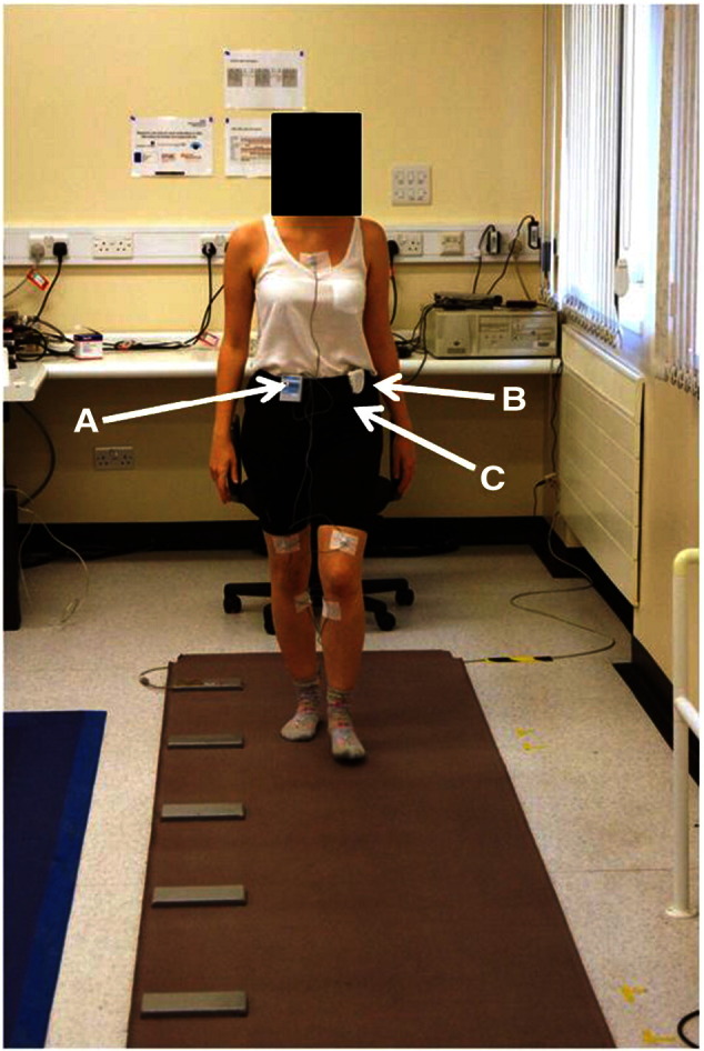 Fig. 1