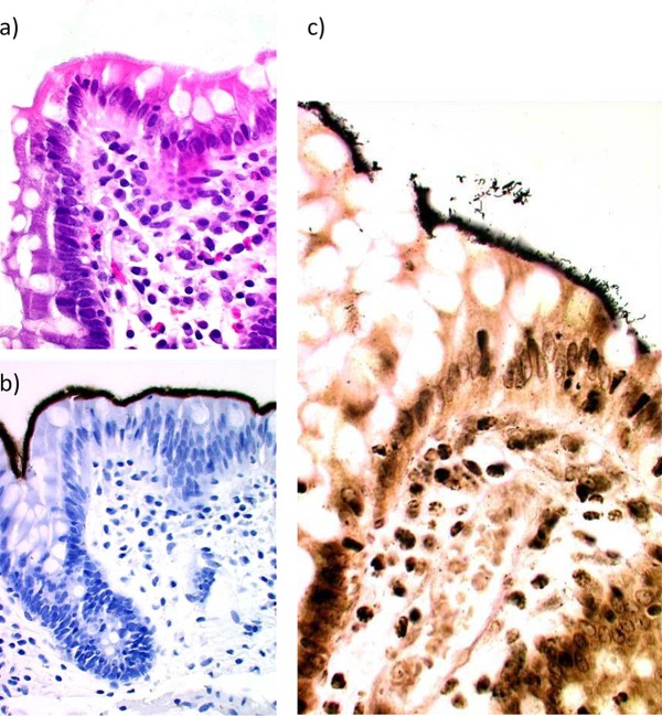 FIG 1