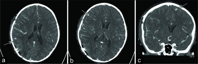 Figure 3: